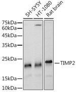 TIMP2 Antibody in Western Blot (WB)