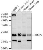 TIMP2 Antibody in Western Blot (WB)