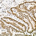 FTO Antibody in Immunohistochemistry (Paraffin) (IHC (P))