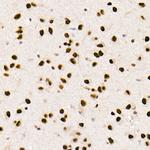 FTO Antibody in Immunohistochemistry (Paraffin) (IHC (P))