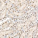 FTO Antibody in Immunohistochemistry (Paraffin) (IHC (P))