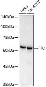 FTO Antibody in Western Blot (WB)