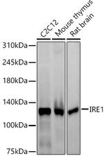 IRE1 alpha Antibody in Western Blot (WB)