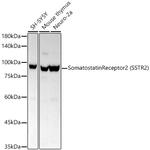 SSTR2 Antibody in Western Blot (WB)