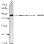 SSTR2 Antibody in Western Blot (WB)