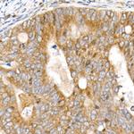 CHOP Antibody in Immunohistochemistry (Paraffin) (IHC (P))