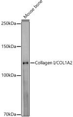 COL1A2 Antibody in Western Blot (WB)