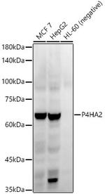 P4HA2 Antibody in Western Blot (WB)