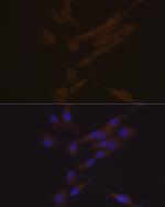 CHI3L1 Antibody in Immunocytochemistry (ICC/IF)