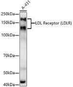 LDLR Antibody in Western Blot (WB)