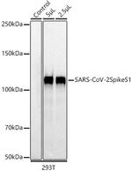 SARS-CoV-2 Spike Protein S1 Antibody in Western Blot (WB)