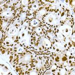 DNA-PK Antibody in Immunohistochemistry (Paraffin) (IHC (P))