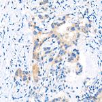 FGFR1 Antibody in Immunohistochemistry (Paraffin) (IHC (P))