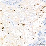 FGFR1 Antibody in Immunohistochemistry (Paraffin) (IHC (P))