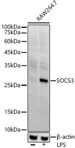 SOCS3 Antibody in Western Blot (WB)