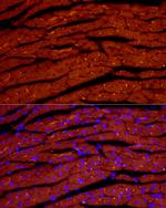 ANP Antibody in Immunocytochemistry (ICC/IF)