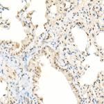 TFEB Antibody in Immunohistochemistry (Paraffin) (IHC (P))