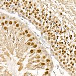 TFEB Antibody in Immunohistochemistry (Paraffin) (IHC (P))