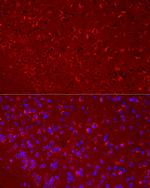 DKK3 Antibody in Immunocytochemistry (ICC/IF)