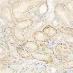 AMID Antibody in Immunohistochemistry (Paraffin) (IHC (P))