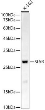 STAR Antibody in Western Blot (WB)