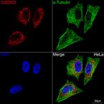 GSDMD Antibody in Immunocytochemistry (ICC/IF)