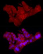 Claudin 1 Antibody in Immunocytochemistry (ICC/IF)