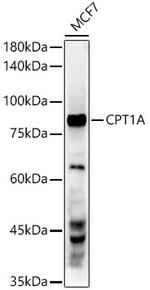 CPT1A Antibody in Western Blot (WB)