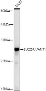 ANT Antibody in Western Blot (WB)