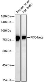 PKC beta Antibody in Western Blot (WB)