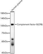 Complement Factor B Antibody in Western Blot (WB)