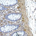 Caveolin 1 Antibody in Immunohistochemistry (Paraffin) (IHC (P))