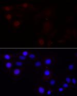 Aurora B Antibody in Immunocytochemistry (ICC/IF)