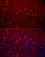 Calretinin Antibody in Immunocytochemistry (ICC/IF)