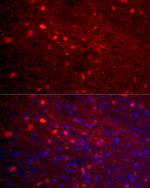 Calretinin Antibody in Immunocytochemistry (ICC/IF)