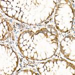 Calretinin Antibody in Immunohistochemistry (Paraffin) (IHC (P))