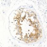 SPAM1 Antibody in Immunohistochemistry (Paraffin) (IHC (P))