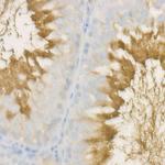 SPAM1 Antibody in Immunohistochemistry (Paraffin) (IHC (P))