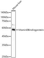 GC Antibody in Western Blot (WB)