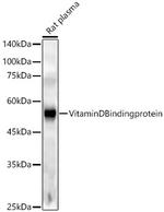 GC Antibody in Western Blot (WB)