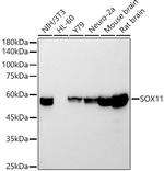 SOX11 Antibody in Western Blot (WB)