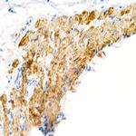 VDAC2 Antibody in Immunohistochemistry (Paraffin) (IHC (P))