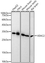 VDAC2 Antibody in Western Blot (WB)