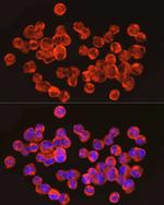 IGF2BP1 Antibody in Immunocytochemistry (ICC/IF)