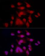MiTF Antibody in Immunocytochemistry (ICC/IF)