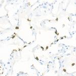 S100A9 Antibody in Immunohistochemistry (Paraffin) (IHC (P))