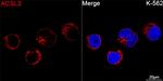 ACSL3 Antibody in Immunocytochemistry (ICC/IF)