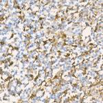 Gelsolin Antibody in Immunohistochemistry (Paraffin) (IHC (P))