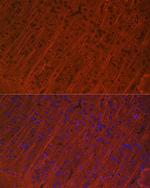 MAP2 Antibody in Immunocytochemistry (ICC/IF)