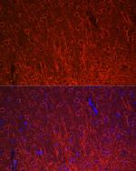 MAP2 Antibody in Immunocytochemistry (ICC/IF)